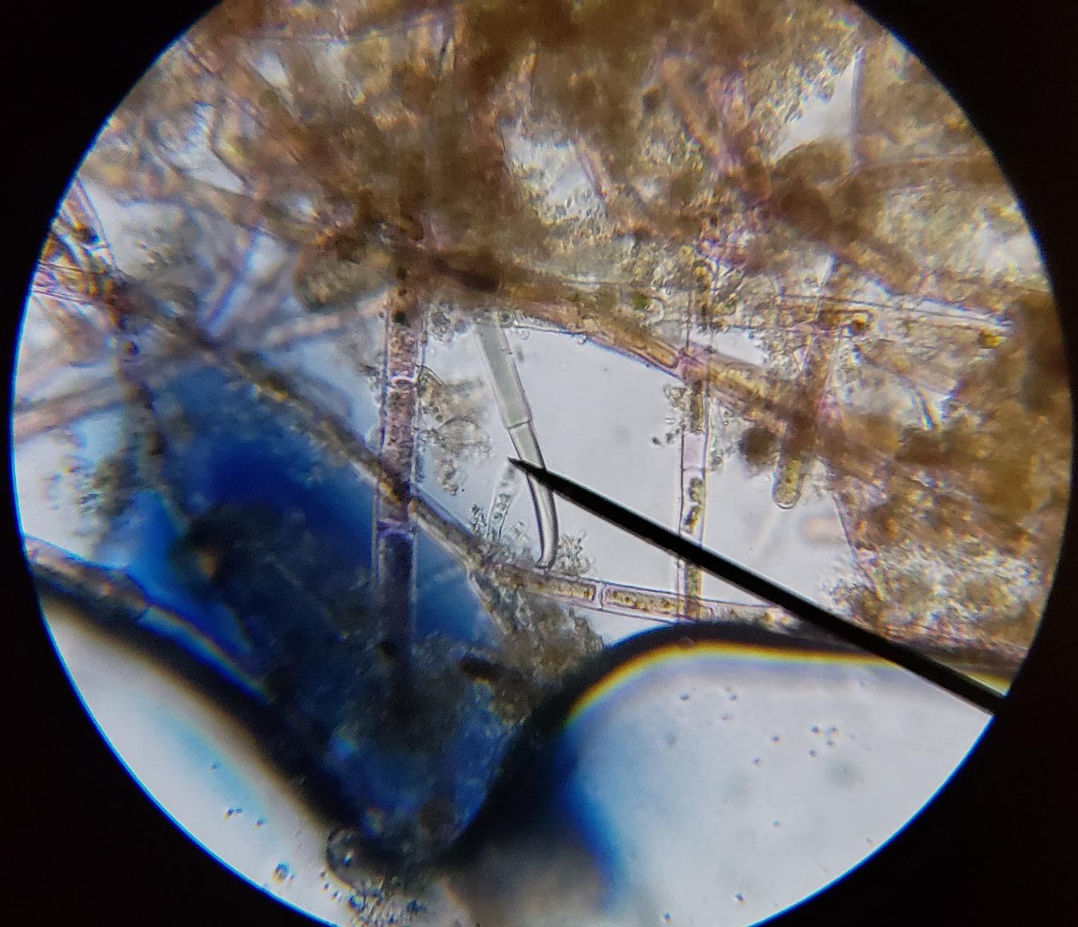 AmScope M150C / M150C-I 40X-1000X All-Metal Optical Glass Lenses Cordless LED Student Biological Compound Microscope customer photo 1