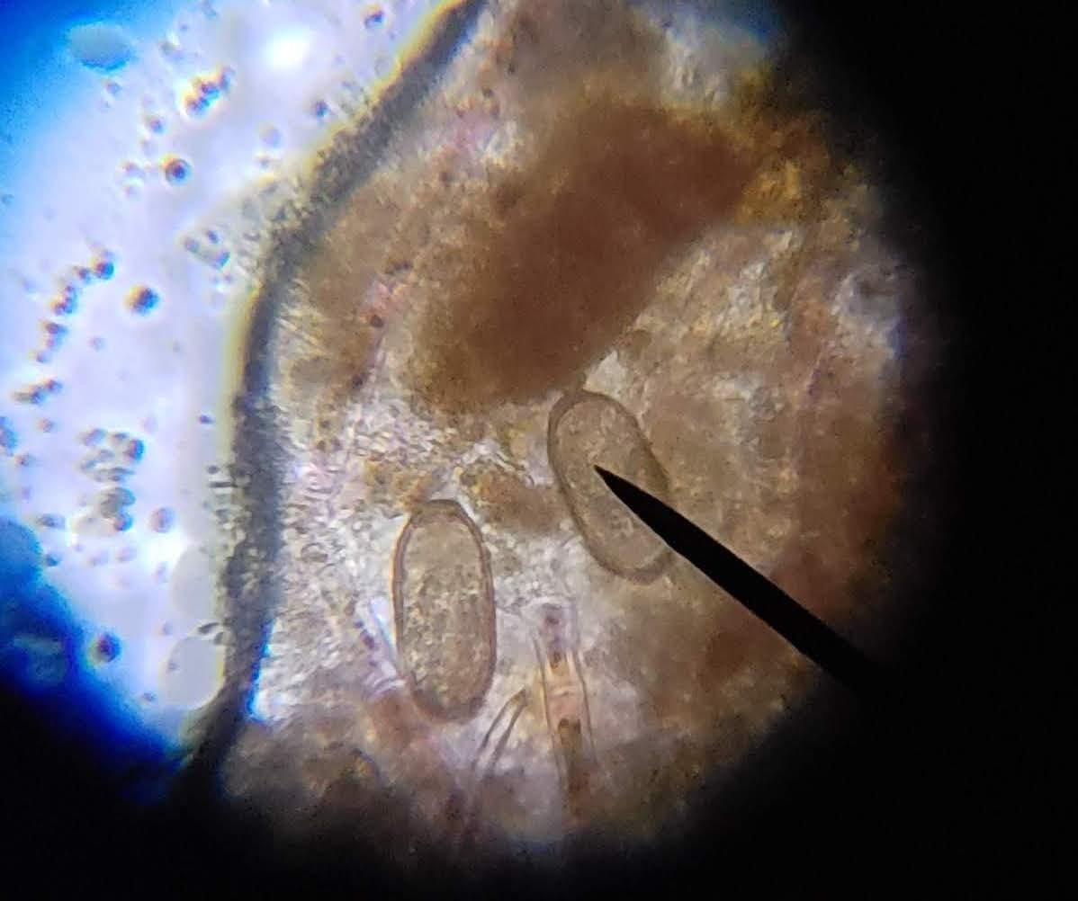 AmScope M150C / M150C-I 40X-1000X All-Metal Optical Glass Lenses Cordless LED Student Biological Compound Microscope customer photo 2