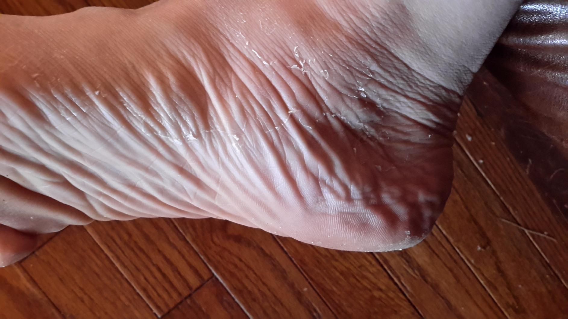 Baby Foot Original Exfoliation Foot Peel - For Rough Cracked, Dry Feet, Dead Skin Removal - Foot Peeling Mask for Baby Soft Feet - Spa Experience at Home & Gift Ideas - Lavender Scented customer photo 2