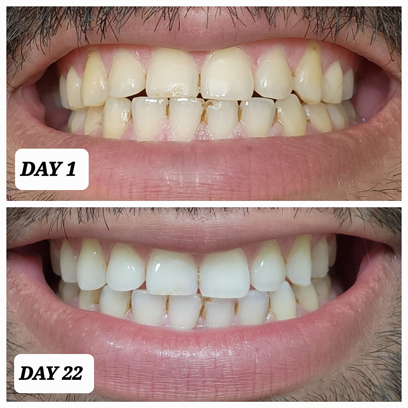 Crest Teeth Whitening Strips, Crest 3D Whitestrips Professional Effects, Enamel Safe Teeth Whitening Kit, 22 Treatments (44 Strips), Professional-Level Whitening, 19 Levels Whiter customer photo 2