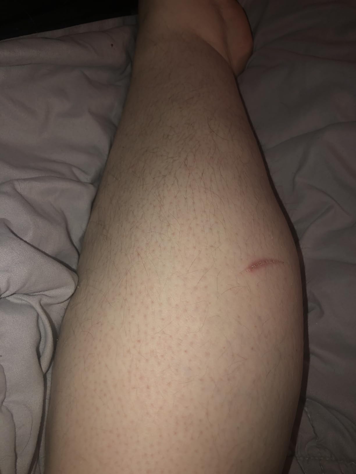 Philips SatinShave Essential Women's Wet & Dry Electric Shaver for Legs & Body, Cordless, with Hypoallergenic Foil, HP6306/50 customer photo 1