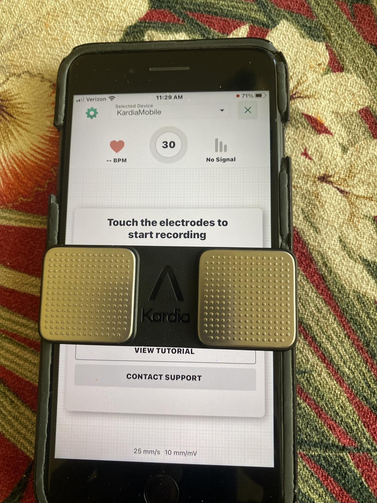 KardiaMobile 1-Lead EKG Monitor, Medical-Grade FDA-Cleared Personal Heart Monitor, Detects Normal, AFib & Arrhythmias, 30 Second Results, Works with Most Smartphones, HSA&FSA Eligible customer photo 1