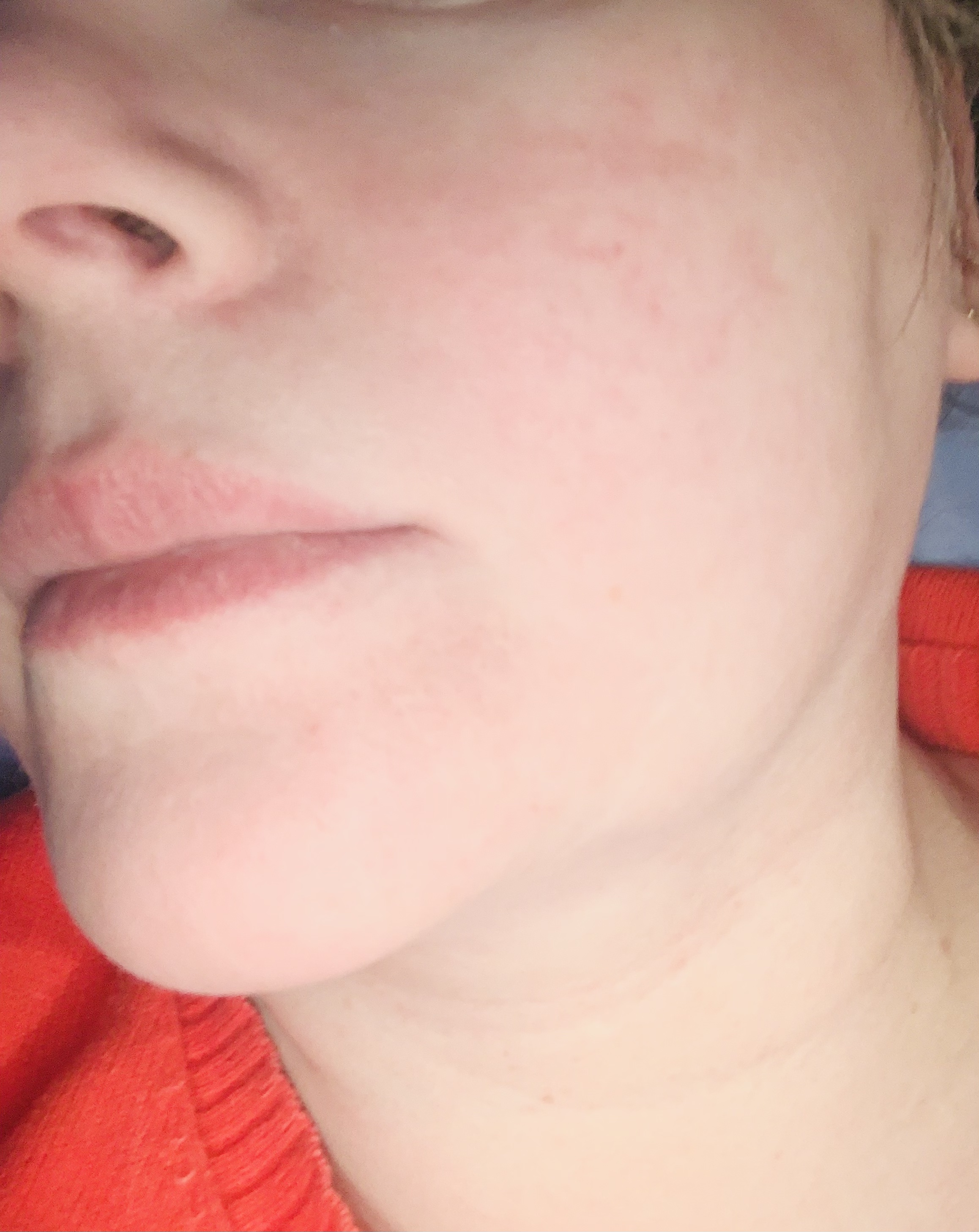 Trophy Skin MicrodermMD - At Home Microdermabrasion Kit - Anti Aging and Acne Treatment - Contains Real Diamond and Pore Extractor Tips to Rejuvenate Skin - White customer photo 2