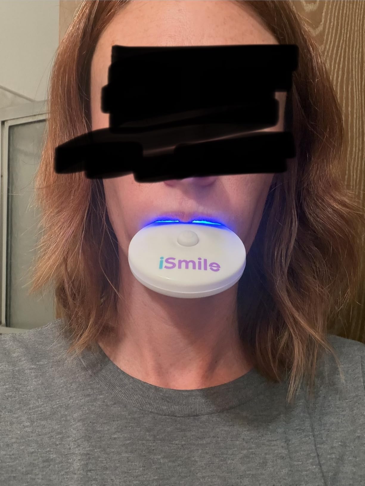 iSmile Teeth Whitening Kit - LED Light, 35% Carbamide Peroxide, (3) 3ml Gel Syringes, (1) Remineralization Gel, and Tray customer photo 1