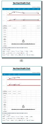 OMRON Complete 2-in-1 Blood Pressure Monitor + EKG for Home Use | Upper Arm Blood Pressure Cuff - #1 Doctor & Pharmacist Recommended Brand - Clinically Validated - Connect App customer photo 2