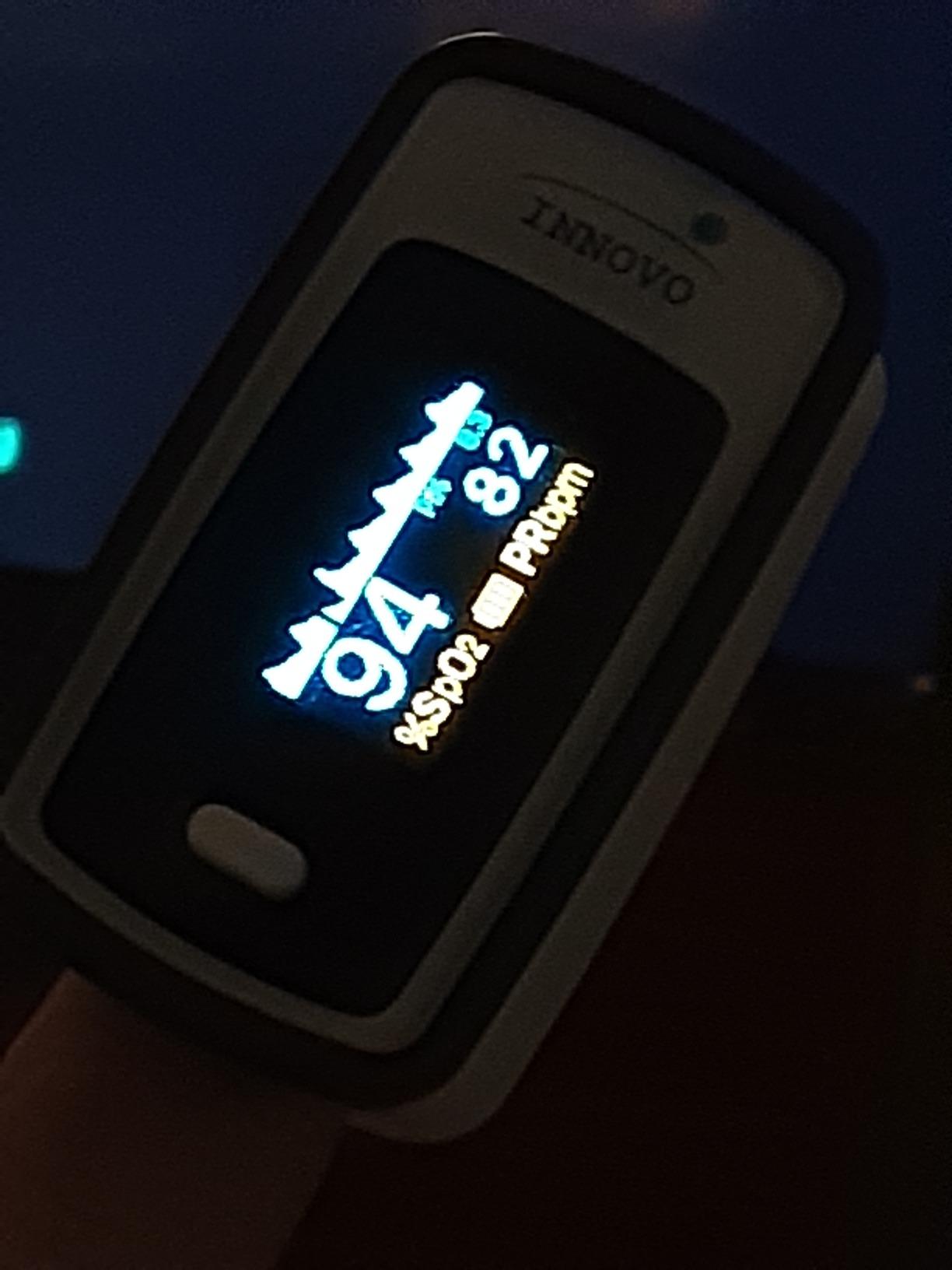 Innovo Deluxe iP900AP Fingertip Pulse Oximeter Blood Oxygen Saturation Monitor with Alarm, Plethysmograph and Perfusion Index customer photo 1