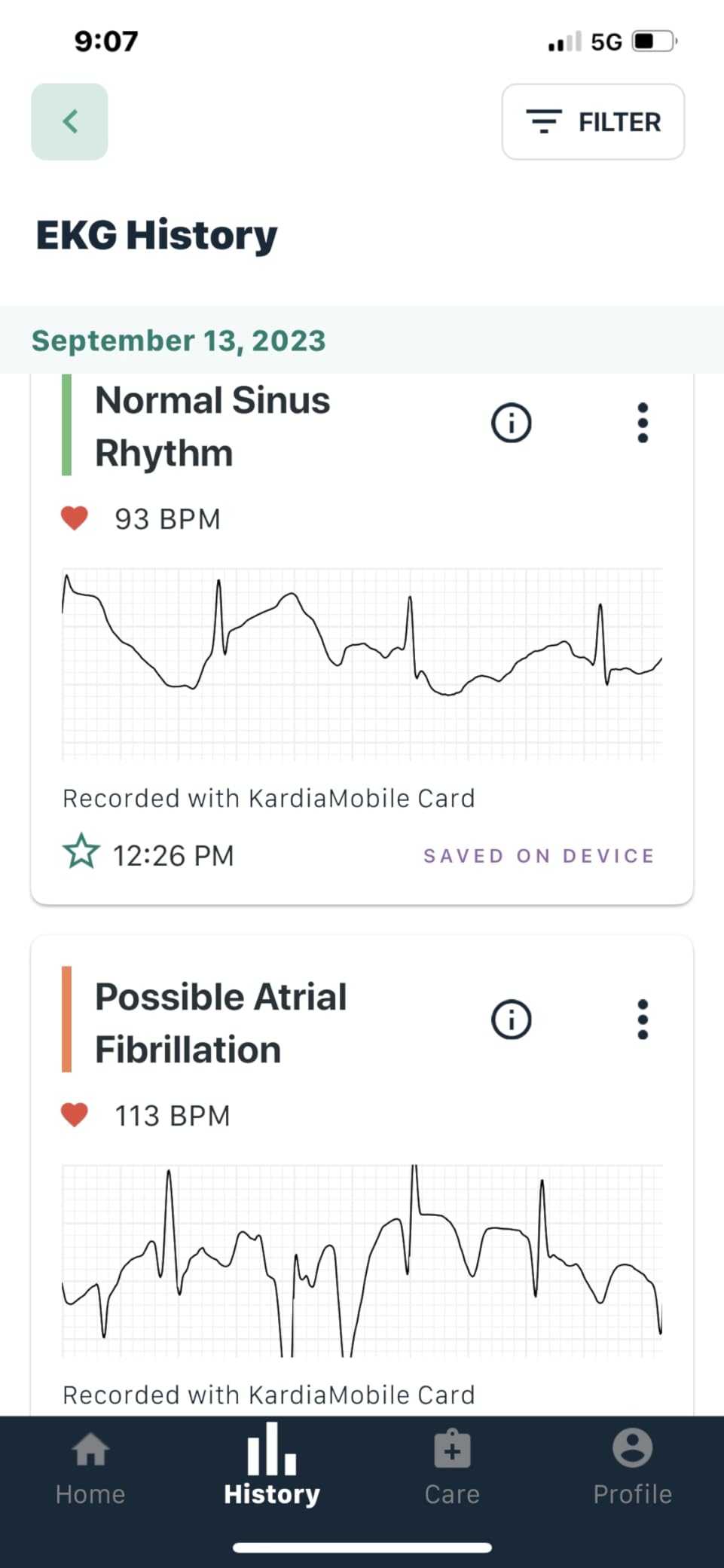 KardiaMobile Card Credit-Card Sized EKG, Medical-Grade & FDA-Cleared Personal Heart Monitor, Bluetooth Enabled, On-The-Go Check-Up Anywhere, Compatible with Most Smartphones, No Subscription Required customer photo 1