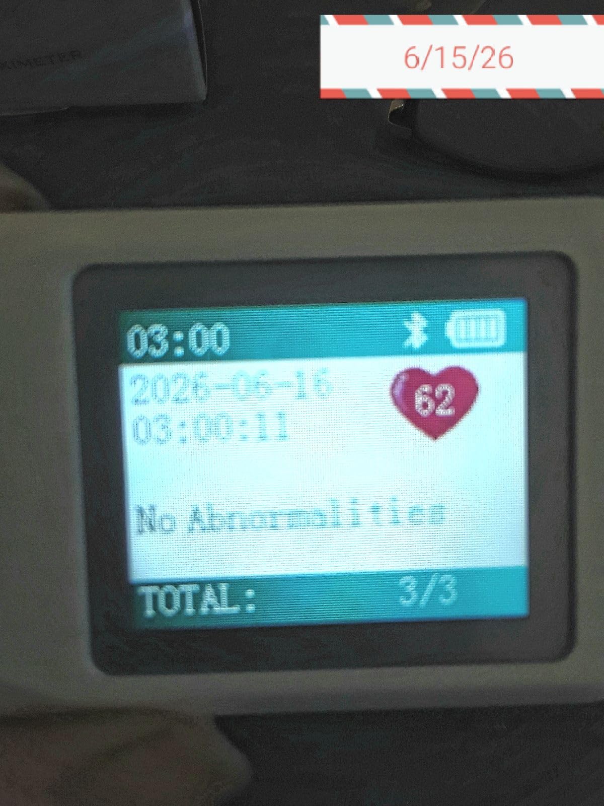 EMAY Portable ECG Monitor | Record ECG and Heart Rate | Compatible with Smartphone and PC customer photo 1
