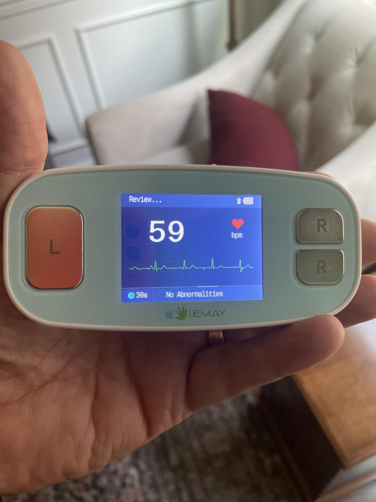 EMAY 6L Portable ECG Monitor | Record ECG and Heart Rate in 6 Channels | Compatible with Smartphone and PC | No Subscription Required customer photo 2