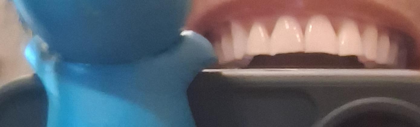 Crest 3D Whitestrips Sensitive & Gentle + LED Light - Teeth Whitening Kit, 1 Light + 14 Treatments, 28 Strips customer photo 2