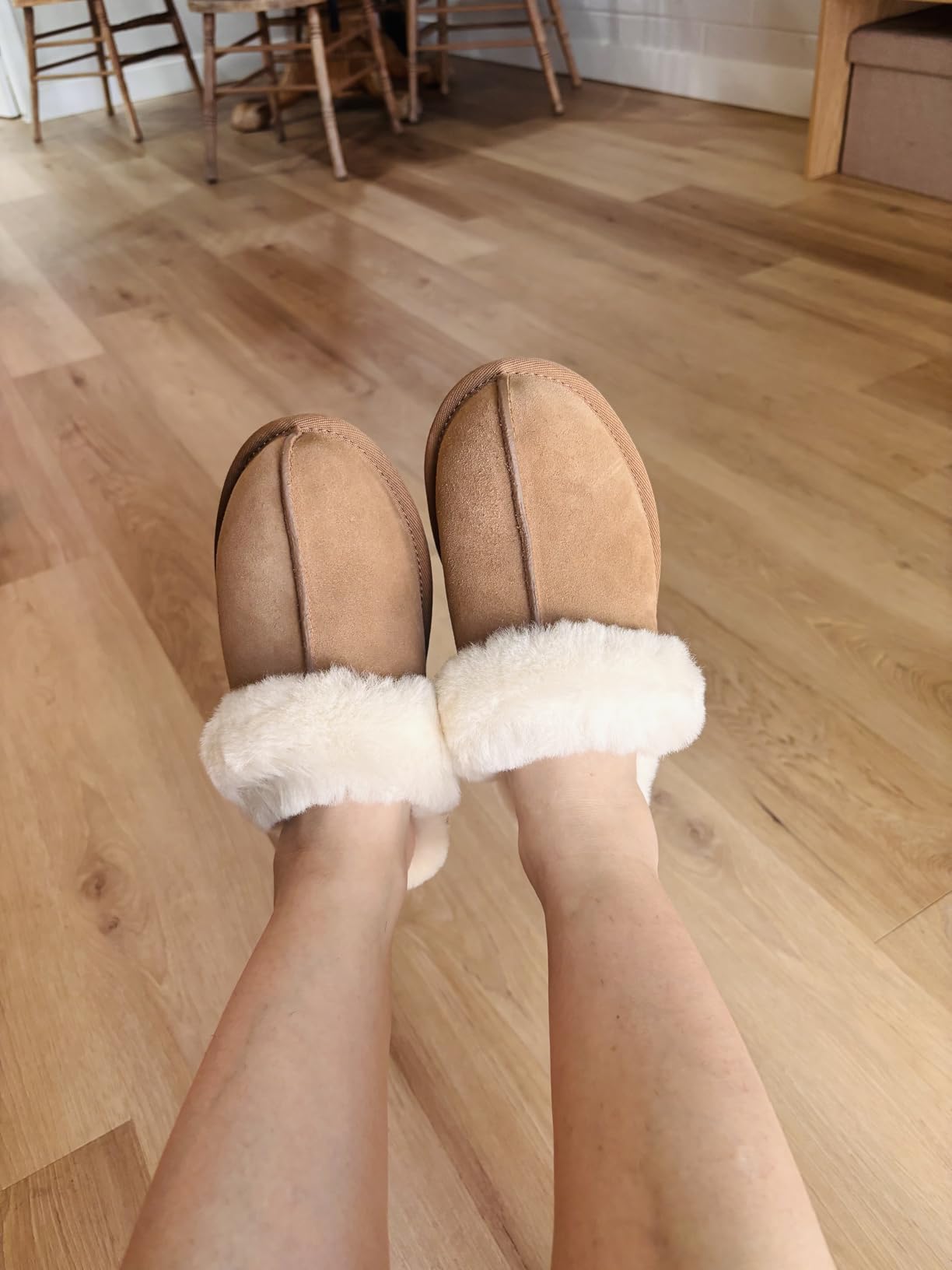 UGG Scuffette II customer photo 1