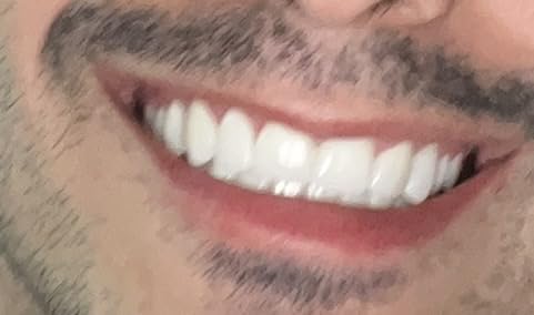 Oral-B iO2 customer photo 1