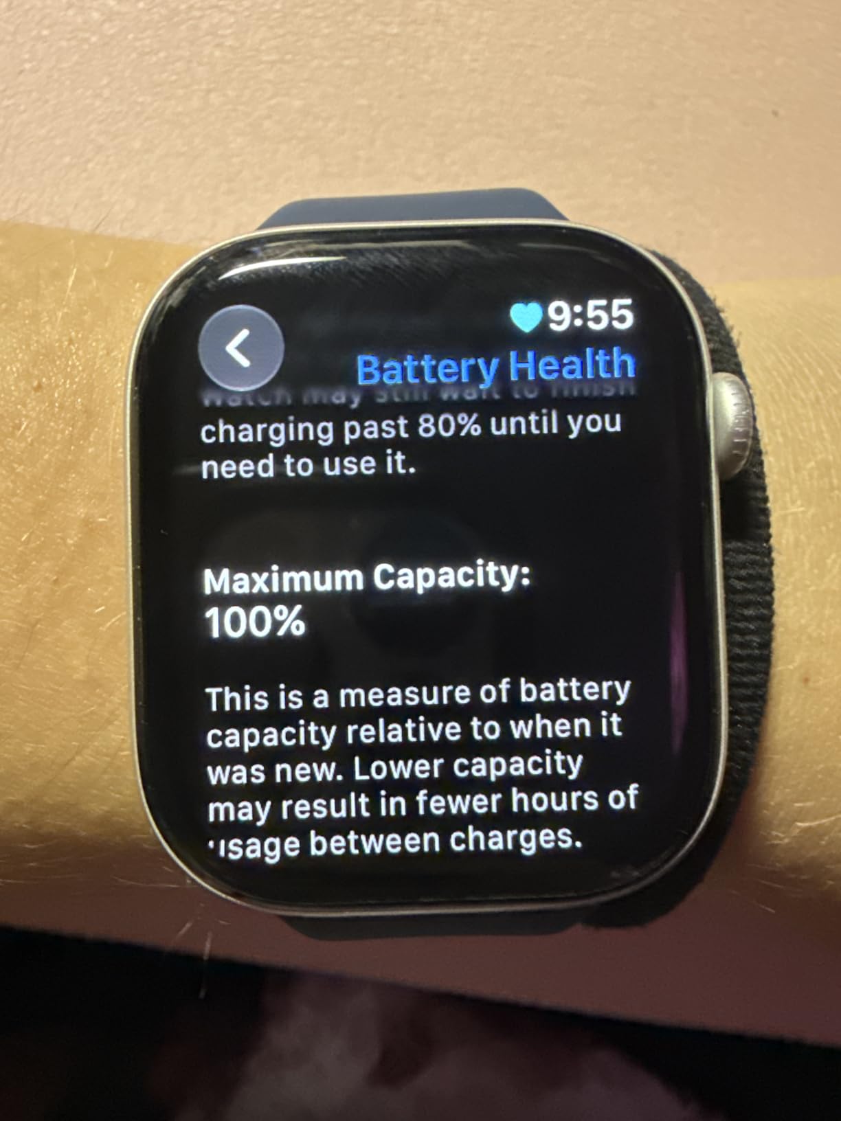 Apple Watch Series 10 Renewed customer photo 1